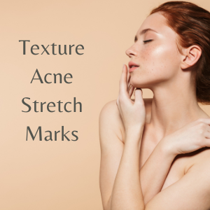 Texture acne stretch marks