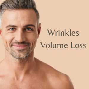 Wrinkles Volume Loss